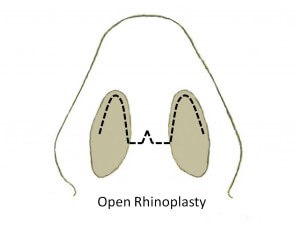 open