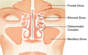 sinus pictures designed by Dr. Garrett Bennett