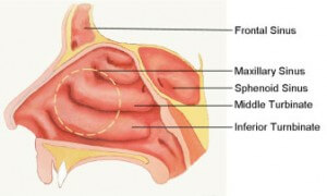 Side view of the areas generally effected by the surgery