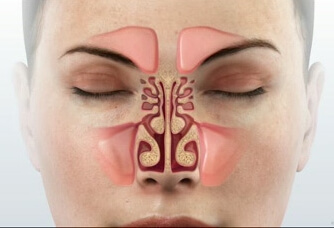 Normal Sinuses