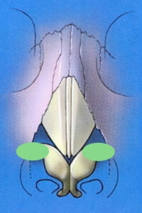 alar_batten_gr2